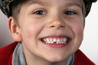 stock photo of a girl with braces