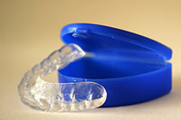 photo of a retainer